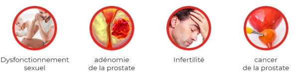 prostate, élargissement de la prostate, gélules, homme