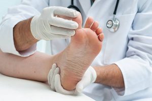 Infection fongique sur les pieds – Symptômes et traitement