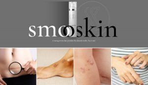 SmooSkin Avis – Solution pour les cicatrices et les vergetures ? Plaintes et utilisateurs insatisfaits