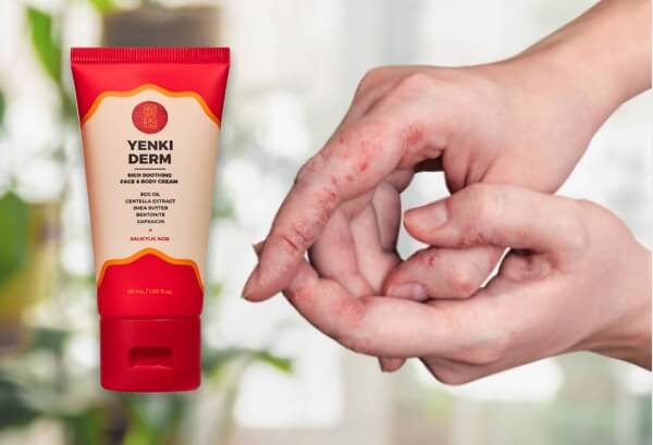 Yenki Derm Crème France Belgique - Prix où acheter Avis Mode d'emploi